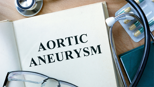 Aortic Aneurysm - Abnormal Weakness in the Aortic Artery
